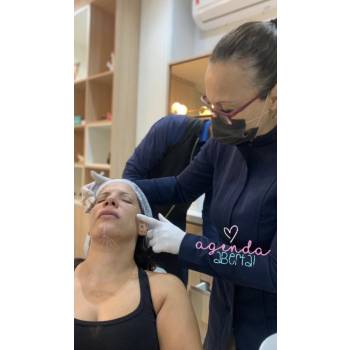Bioestimulador Colageno em Santo André Bioestimulador Colageno em Santo André